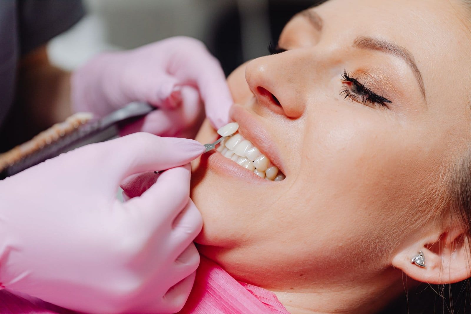 Porcelain Veneers Precision-Crafted Smiles at Village Dental of New England